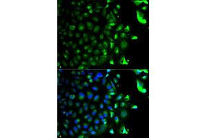 Immunofluorescence analysis of HeLa cells using RAB5A antibody. (RAB5 抗体)