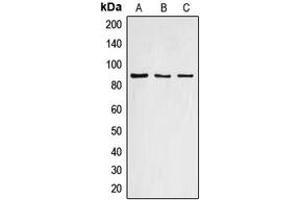 Western blot analysis of Cyclin F expression in HEK293T (A), mouse liver (B), rat liver (C) whole cell lysates. (Cyclin F 抗体  (C-Term))