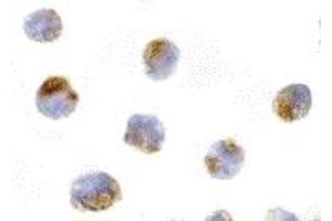 Immunohistochemistry (IHC) image for anti-Induced Myeloid Leukemia Cell Differentiation Protein Mcl-1 (MCL1) (Middle Region) antibody (ABIN1030997) (MCL-1 抗体  (Middle Region))