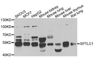 Western blot analysis of extracts of various cell lines, using SPTLC1 antibody. (SPTLC1 抗体  (AA 37-310))