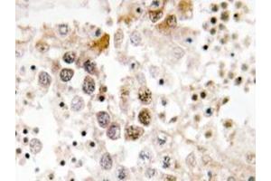 Immunohistochemistry analyzes of FoxL1 antibody in paraffin-embedded human testis tissue. (FOXL1 抗体)