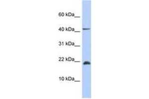 Image no. 1 for anti-SFRS12-Interacting Protein 1 (SFRS12IP1) (AA 71-120) antibody (ABIN6743869) (SFRS12IP1 抗体  (AA 71-120))