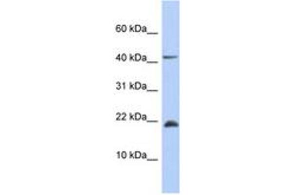 SFRS12IP1 抗体  (AA 71-120)