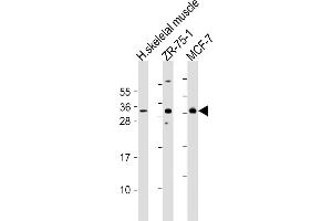 All lanes : Anti-FGF17 Antibody (N-Term) at 1:2000 dilution Lane 1: human skeletal muscle lysates Lane 2: ZR-75-1 whole cell lysates Lane 3: MCF-7 whole cell lysates Lysates/proteins at 20 μg per lane. (FGF17 抗体  (AA 78-112))