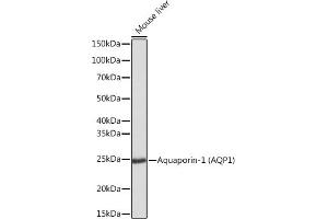 Western blot analysis of extracts of Mouse liver, using Aquaporin-1 (Aquaporin-1 ) Rabbit mAb (ABIN1682901, ABIN3018679, ABIN3018680 and ABIN7101646) at 1:1000 dilution. (Aquaporin 1 抗体)
