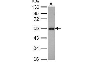 WB Image Sample (30 ug of whole cell lysate) A: Hep G2 , 10% SDS PAGE antibody diluted at 1:1000 (CCDC83 抗体)