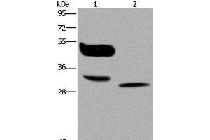 Western Blot analysis of A375 cell and Human lung cancer tissue using MAGEA8 Polyclonal Antibody at dilution of 1:400 (MAGEA8 抗体)
