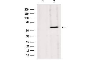 Western blot analysis of extracts from 293, using HMGCS1 antibody. (HMGCS1 抗体  (Internal Region))
