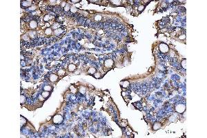 IHC analysis of CD13/Anpep using anti-CD13/Anpep antibody (ABIN7602222).