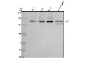 Western blot analysis of UPF1 using anti-UPF1 antibody (ABIN7606163).