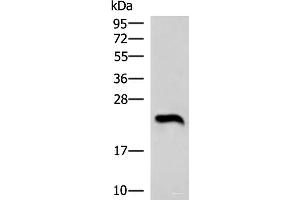 Western blot analysis of Human heart tissue lysate using NEUROG3 Polyclonal Antibody at dilution of 1:1000 (Neurogenin 3 抗体)