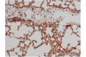 ABIN6267333 at 1/200 staining Mouse lung tissue sections by IHC-P. (SP1 抗体  (pThr453))