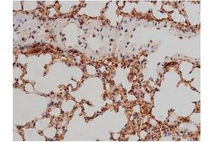 ABIN6267333 at 1/200 staining Mouse lung tissue sections by IHC-P.