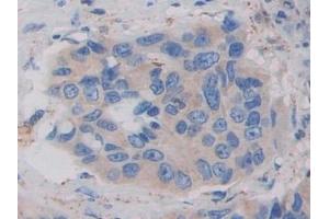 Immunohistochemistry (IHC) image for anti-DEAD (Asp-Glu-Ala-Asp) Box Polypeptide 58 (DDX58) (AA 550-776) antibody (ABIN7433744)