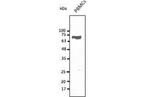 Western Blotting (WB) image for anti-CD5 (CD5) (AA 105-210) antibody (ABIN7272988) (CD5 抗体  (AA 105-210))