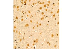 Immunohistochemistry of paraffin embedded rat brain using scr3 (ABIN7074886) at dilution of 1:1000 (400x lens) (NCOA3 抗体)