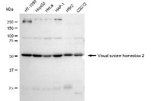 anti-Visual System Homeobox 2 (VSX2) antibody