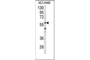 Image no. 1 for anti-Cytochrome P450, Family 3, Subfamily A, Polypeptide 4 (CYP3A4) (Middle Region) antibody (ABIN360097) (CYP3A4 抗体  (Middle Region))