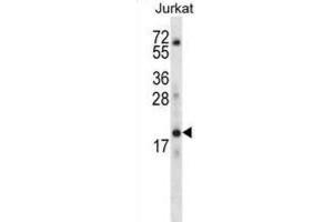 Western Blotting (WB) image for anti-Keratin Associated Protein 13-3 (KRTAP13-3) antibody (ABIN2996741)