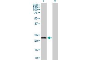 Western Blot analysis of FBXO36 expression in transfected 293T cell line by FBXO36 MaxPab polyclonal antibody. (FBXO36 抗体  (AA 1-188))
