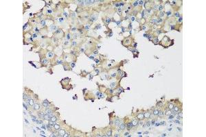 Immunohistochemistry of paraffin-embedded Human prostate using NEDD4L Polyclonal Antibody at dilution of 1:200 (40x lens). (NEDD4-2 抗体)