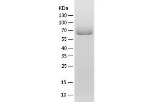 Western Blotting (WB) image for Acyl-CoA Synthetase Family Member 2 (ACSF2) (AA 42-615) protein (His tag) (ABIN7288289) (ACSF2 Protein (AA 42-615) (His tag))