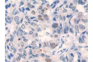 Immunohistochemistry (IHC) image for anti-Chemokine (C-X3-C Motif) Ligand 1 (CX3CL1) (AA 81-336) antibody (ABIN1858577)