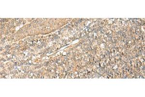 Immunohistochemistry of paraffin-embedded Human tonsil tissue using NID2 Polyclonal Antibody at dilution of 1:70(x200) (NID2 抗体)