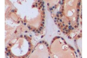 Immunohistochemistry (IHC) image for anti-Glutathione S-Transferase pi 1 (GSTP1) (AA 1-210) antibody (ABIN7433147)
