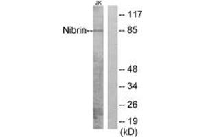 Western blot analysis of extracts from Jurkat cells, using Nibrin (Ab-278) Antibody. (Nibrin 抗体  (AA 251-300))