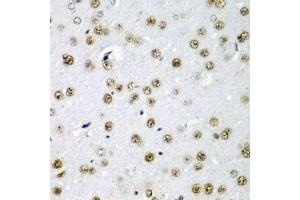 Immunohistochemistry of paraffin-embedded rat brain using SF3B3/S antibody (ABIN6128696, ABIN6147668, ABIN6147669 and ABIN6221751) at dilution of 1:200 (40x lens). (SF3B3 抗体  (AA 948-1217))