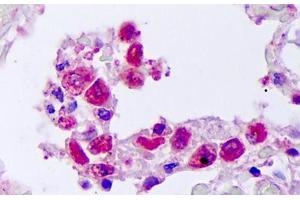 Anti-TNFSF10 / TRAIL antibody IHC staining of human lung, macrophages.