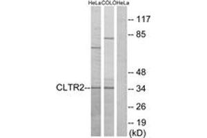 Western blot analysis of extracts from HeLa/COLO cells, using CLTR2 Antibody. (CasLTR2 抗体  (AA 281-330))