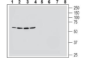 Western blot analysis of human  colon adenocarcinoma cell line lysate (lanes 1 and 5), human Jurkat T-cell leukemia cell line lysate (lanes 2 and 6), human K562 myelogenous leukemia cell line lysate (lanes 3 and 7) and human  natural killer cell line lysate (lanes 4 and 8):1-4. (Neuromedin U Receptor 1 (NMUR1) Peptide)