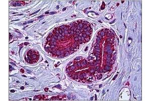 Human Breast: Formalin-Fixed, Paraffin-Embedded (FFPE) (MT-ATP6 抗体  (Subunit alpha))