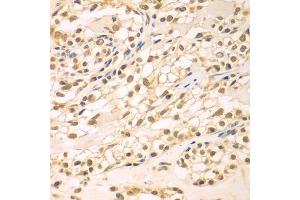 Immunohistochemistry of paraffin-embedded human kidney using TBL1XR1 antibody (ABIN5975754) at dilution of 1/100 (40x lens). (TBL1XR1 抗体)