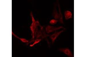 ABIN6275480 staining NIH-3T3 cells by IF/ICC. (RGS14 抗体  (Internal Region))