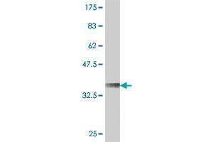 Western Blot detection against Immunogen (37. (Syndetin/VPS50 抗体  (AA 862-964))