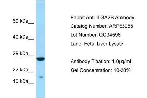 Western Blotting (WB) image for anti-Integrin Alpha2b (CD41) (N-Term) antibody (ABIN2789680) (Integrin Alpha2b 抗体  (N-Term))
