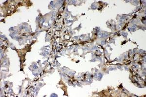 IHC analysis of S100A4 using anti-S100A4 antibody (ABIN7600462). (s100a4 抗体  (AA 2-101))