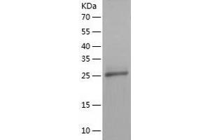 Western Blotting (WB) image for HAUS Augmin-Like Complex, Subunit 1 (HAUS1) (AA 1-278) protein (His tag) (ABIN7288291) (HAUS1 Protein (AA 1-278) (His tag))