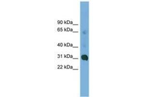 Image no. 1 for anti-Coiled-Coil Domain Containing 127 (CCDC127) (AA 35-84) antibody (ABIN6745006) (CCDC127 抗体  (AA 35-84))