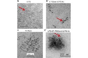 immunoelectron microscopy (IEM) images of LPS using ABIN479062. (Lipopolysaccharides (LPS) 抗体)