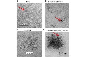 immunoelectron microscopy (IEM) images of LPS using ABIN479062.