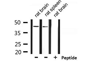 Western blot analysis of extracts from  rat brain and rat spleen, using ZADH2 Antibody. (ZADH2 抗体  (Internal Region))