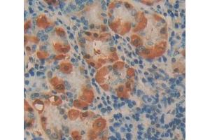 #VALUE! (Phospholipase C beta 2 抗体  (AA 1-250))