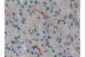 Immunohistochemistry (IHC) image for anti-Phospholipase A2, Group IVA (Cytosolic, Calcium-Dependent) (PLA2G4A) (AA 563-749) antibody (ABIN7438268)