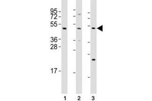 Western blot testing of Mlkl antibody at 1:2000 dilution and mouse samples: (1) testis, (2) liver, (3) NIH3T3 lysate; Predicted size: 54 kDa. (MLKL 抗体  (AA 444-472))