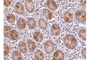 Immunohistochemistry (Paraffin-embedded Sections) (IHC (p)) image for anti-Apoptosis Antagonizing Transcription Factor (AATF) antibody (ABIN499185)