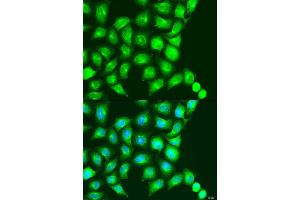 Immunofluorescence analysis of U2OS cells using UBIAD1 antibody (ABIN2737790) at dilution of 1:100. (UBIAD1 抗体)